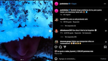 Justin Bieber confesó que tiene