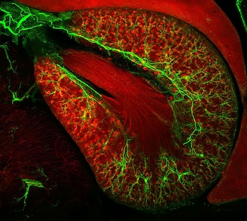 El nuevo microscopio acelera el