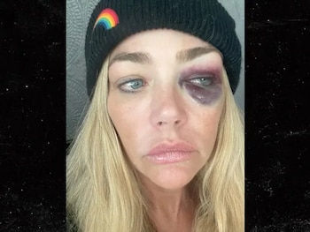 Denise Richards adjuntó fotografías de