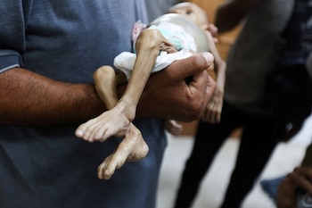 Un hombre lleva el cuerpo