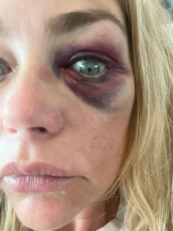Denise Richards denunció episodios de